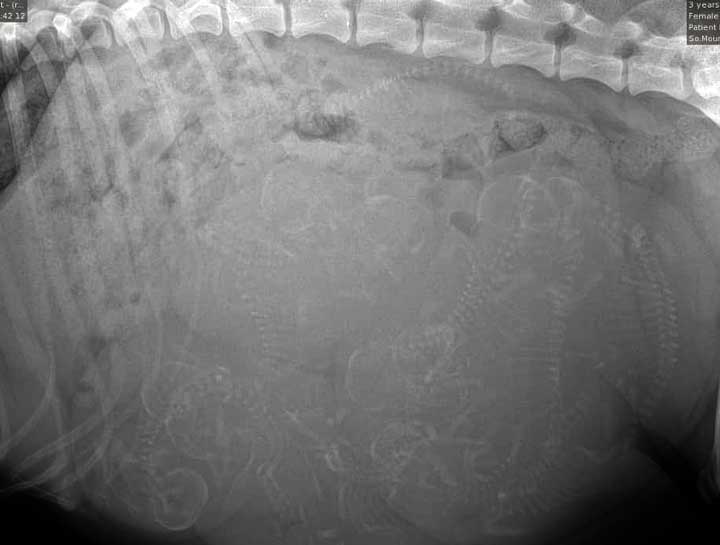 Fetal Digital Radiology